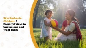 Skin Rashes in Children - 5 Powerful Ways to Understand and Treat Them